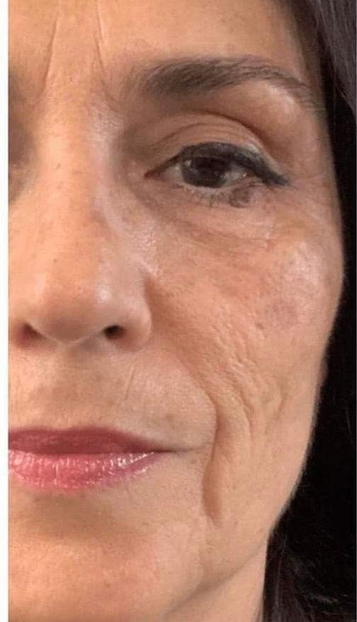 Antes